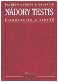 Nádory testis - diagnostika a liečba