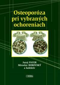 Osteoporóza pri vybraných ochoreniach